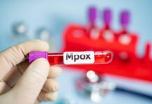 Mpox em Minas Gerais chega a 7 casos, todos em homens